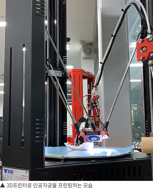 ▲ 3D프린터로 인공자궁을 프린팅하는 모습